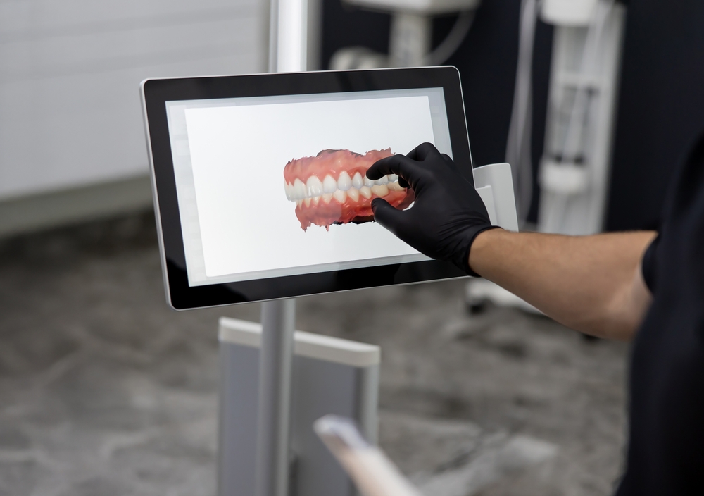 3D Scanning