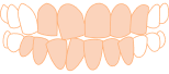 Moderate